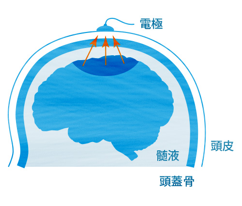 電極を頭皮上に配置