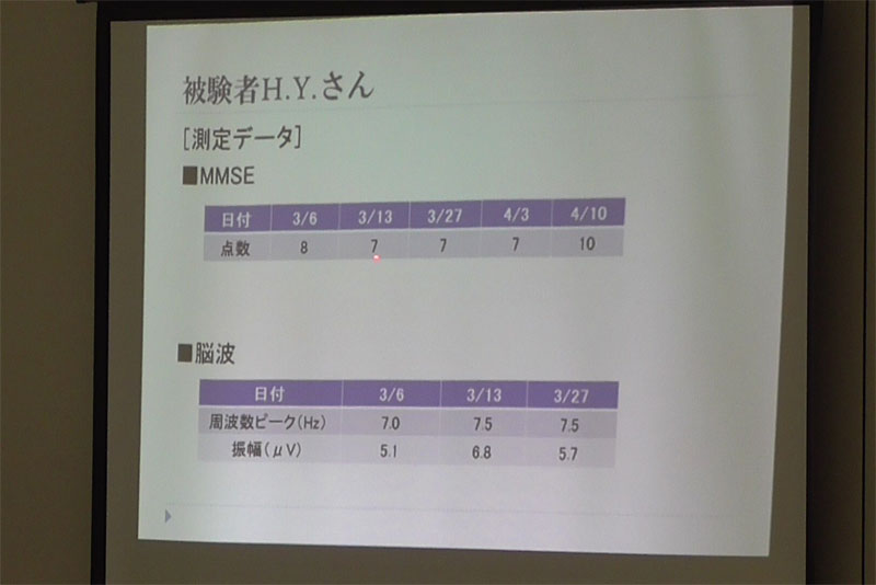 MMSEの点数アップ