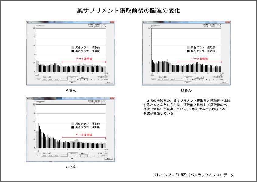 サプリ摂取前後の脳波