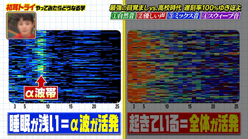 睡眠脳波を観察