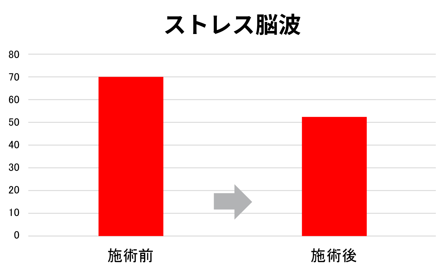 ストレス脳波減少